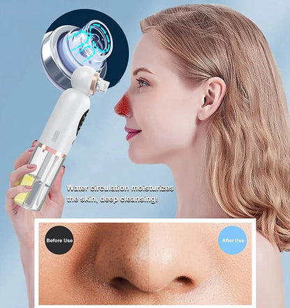 Super Micro Bubble Beauty Instrument And Blackhead Remover